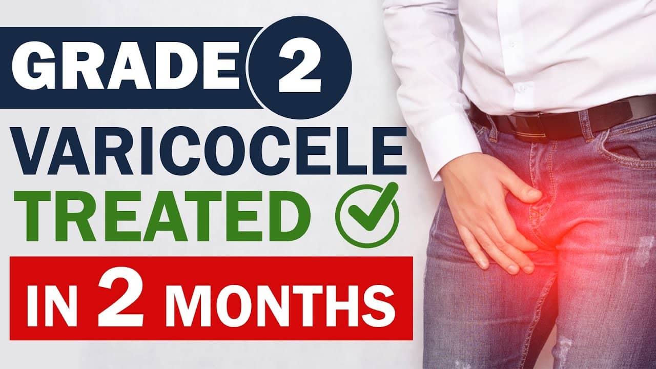 A Guide to Varicocele Treatment in Singapore