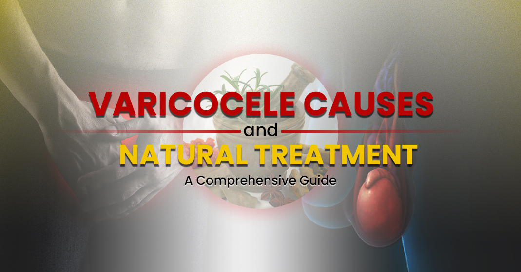 Varicocele Causes and Natural Treatment: A Comprehensive Guide