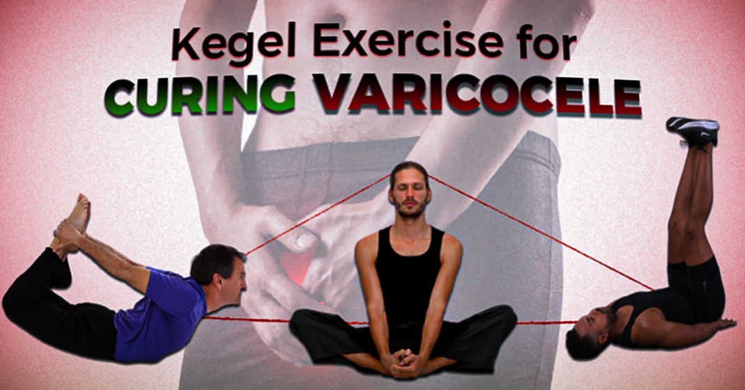 Kegel Exercise for Curing Varicocele: Treat Varicocele without Surgery