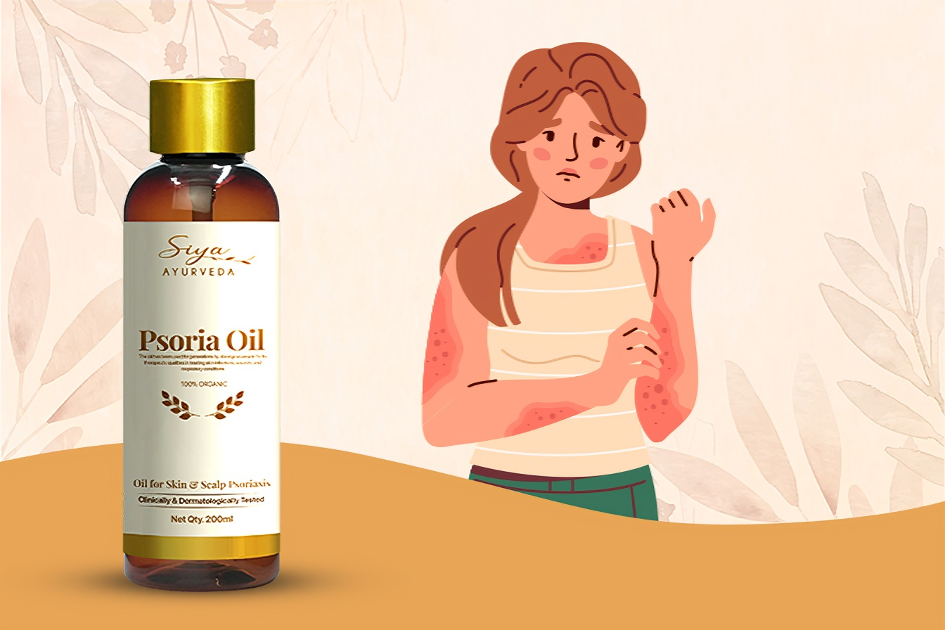 Psoria Oil Herbal Relief for Scalp and Full Body Psoriasis